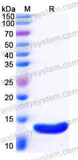 Recombinant Human CCL2/MCP-1 Protein, Tag free