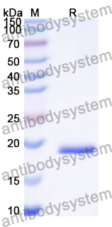 Recombinant Human CFTR Protein, C-His