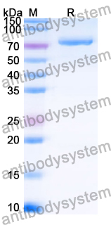 Recombinant Human PDIA4 Protein, C-His