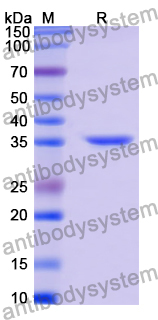 Recombinant Human ALAD Protein, N-His