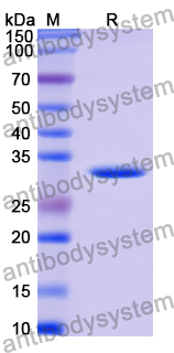 Recombinant Human APEH Protein, N-His