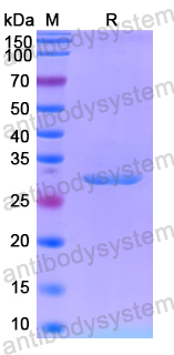 Recombinant Human GYS1 Protein, N-His