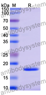 Recombinant Human PRKAR2A Protein, N-His