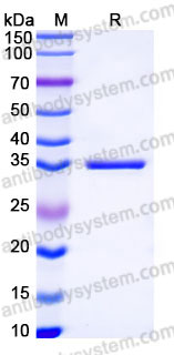 Recombinant Human ANXA8 Protein, Tag free