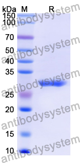 Recombinant Human GTF2F2 Protein, N-His
