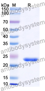 Recombinant Human CCDC130 Protein, N-His