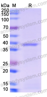 Recombinant Human MTHFD2 Protein, N-His