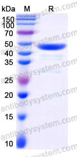 Recombinant Human NCF1 Protein, C-His