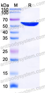 Recombinant Human PKM Protein, N-His