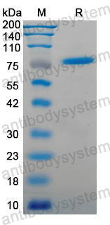 Recombinant Human CCNB1 Protein, N-GST-His