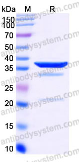 Recombinant Human ETS1 Protein, N-His
