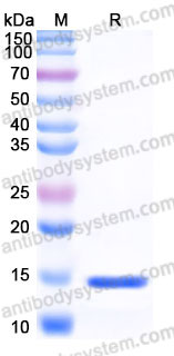 Recombinant Human FABP4 Protein, N-His