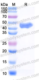 Recombinant Human GLUL Protein, C-His