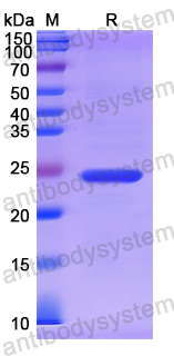 Recombinant Human RAC2 Protein, N-His