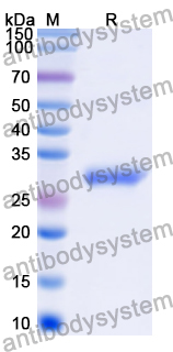 Recombinant Human PGAM2 Protein, N-His