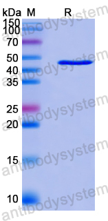 Recombinant Human ATP6V1B1 Protein, N-His