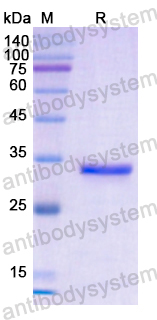 Recombinant Human CD19 Protein, N-His