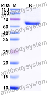 Recombinant Human GNS Protein, N-His