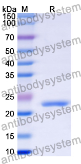 Recombinant Human RPS2 Protein, N-His