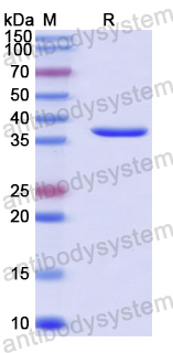 Recombinant Human TCF4 Protein, N-GST & C-His