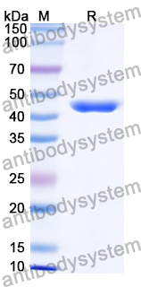 Recombinant Human CD75/ST6GAL1 Protein, N-His