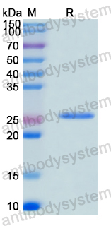 Recombinant Human RPA2 Protein, N-His