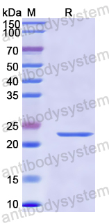 Recombinant Human GATA1 Protein, N-His-SUMO