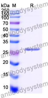 Recombinant Human ACAN Protein, N-His