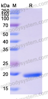 Recombinant Human UGT2B7 Protein, N-His
