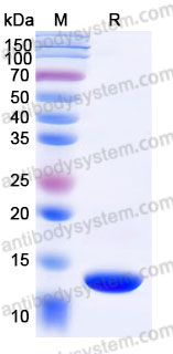 Recombinant Human NT-proBNP Protein, N-His-Flag