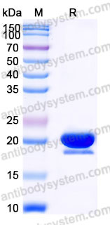 Recombinant Human STMN1 Protein, C-His
