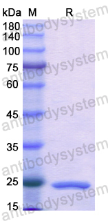 Recombinant Human NAGA Protein, N-His