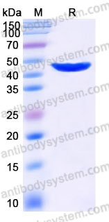 Recombinant Human GOT1 Protein, C-His