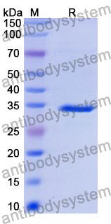 Recombinant Human PRKCA Protein, N-His