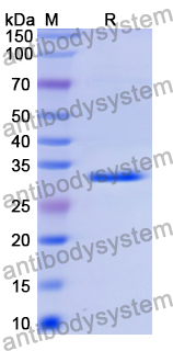 Recombinant Human CD49b/ITGA2 Protein, N-His