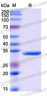 Recombinant Human UBTF Protein, N-GST & C-His