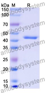 Recombinant Human HOXB9 Protein, N-His-KSI