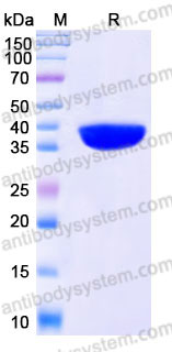 Recombinant Human AKR1C4 Protein, N-His