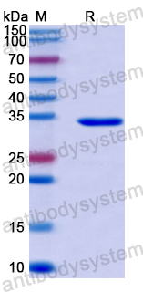 Recombinant Human PRKACA Protein, N-His