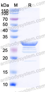 Recombinant Human DES/Desmin Protein, N-His