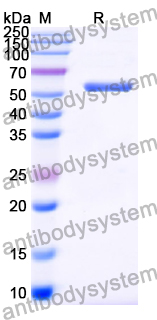 Recombinant Human TPH1 Protein, N-His