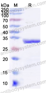 Recombinant Human CHRNB2 Protein, N-His