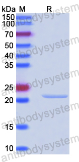 Recombinant Human ARF4 Protein, N-His