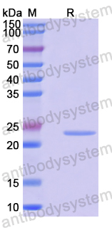 Recombinant Human GABRB1 Protein, N-His