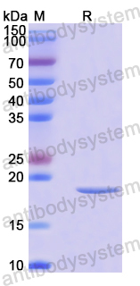 Recombinant Human RPL17 Protein, N-His