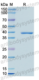 Recombinant Human KRT4 Protein, N-His