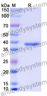 Recombinant Human TSPAN8 Protein, N-GST & C-His