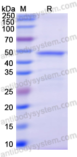 Recombinant Human HDC Protein, C-His