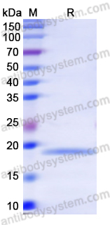 Recombinant Human TNNI1 Protein, N-His