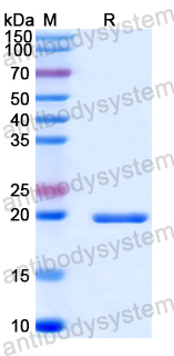 Recombinant Human NDUFV2 Protein, N-His